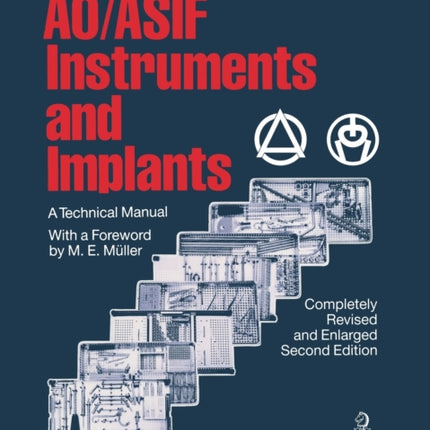 AO/ASIF Instruments and Implants: A Technical