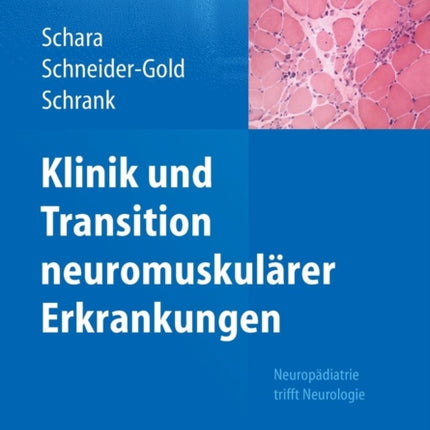 Klinik und Transition neuromuskulärer Erkrankungen: Neuropädiatrie trifft Neurologie