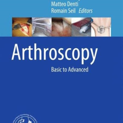 Arthroscopy: Basic to Advanced