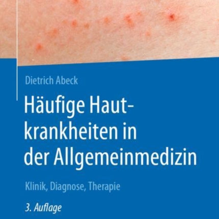 Häufige Hautkrankheiten in der Allgemeinmedizin:
