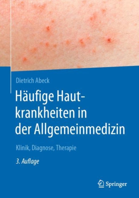 Häufige Hautkrankheiten in der Allgemeinmedizin: