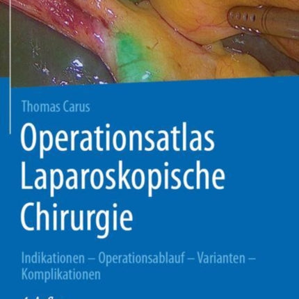 Operationsatlas Laparoskopische Chirurgie