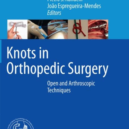 Knots in Orthopedic Surgery: Open and Arthroscopic Techniques