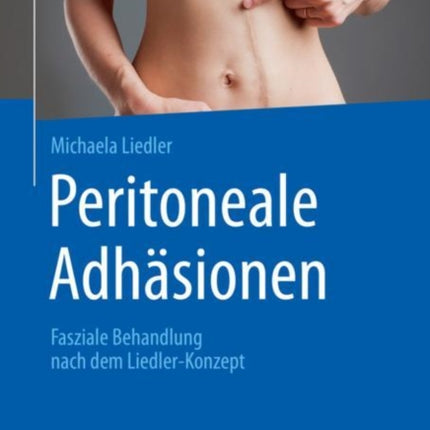 Peritoneale Adhäsionen: Fasziale Behandlung nach