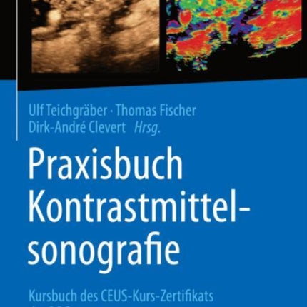 Praxisbuch Kontrastmittelsonografie: Kursbuch des CEUS-Kurs-Zertifikats der DRG