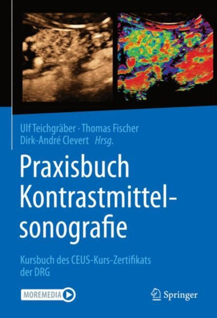 Praxisbuch Kontrastmittelsonografie: Kursbuch des CEUS-Kurs-Zertifikats der DRG