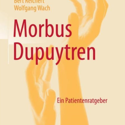 Morbus Dupuytren: Ein Patientenratgeber