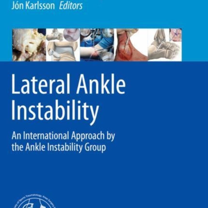 Lateral Ankle Instability: An International
