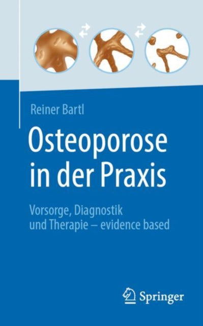 Osteoporose in der Praxis: Vorsorge, Diagnostik