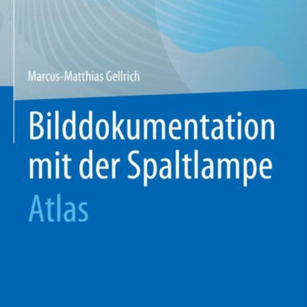 Bilddokumentation mit der Spaltlampe: Atlas