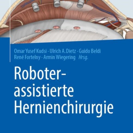 Roboterassistierte Hernienchirurgie