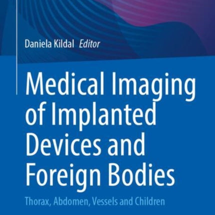 Medical Imaging of Implanted Devices and Foreign Bodies