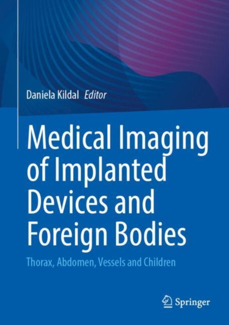 Medical Imaging of Implanted Devices and Foreign Bodies