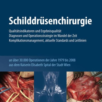 Schilddrüsenchirurgie - Qualitätsindikatoren und Ergebnisqualität, Diagnosen und Operationsstrategie im Wandel der Zeit, Komplikationsmanagement, aktuelle Standards und Leitlinien: an über 30.000 Operationen der Jahre 1979-2008 aus dem Kais