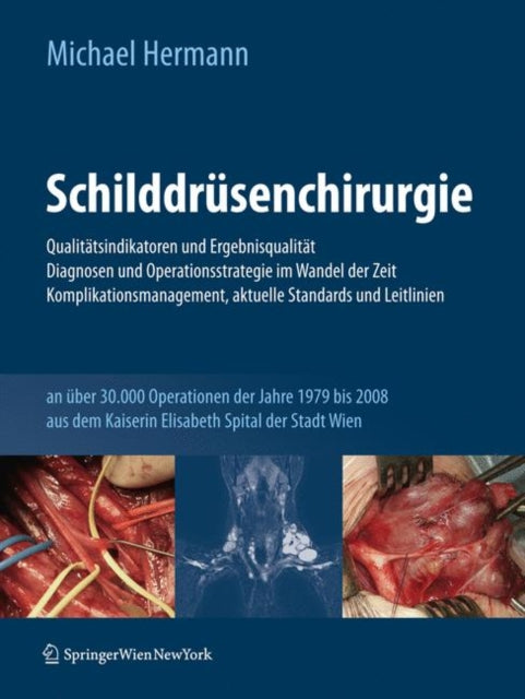 Schilddrüsenchirurgie - Qualitätsindikatoren und Ergebnisqualität, Diagnosen und Operationsstrategie im Wandel der Zeit, Komplikationsmanagement, aktuelle Standards und Leitlinien: an über 30.000 Operationen der Jahre 1979-2008 aus dem Kais