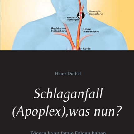 Schlaganfall (Apoplex), was nun?: Zögern kann fatale Folgen haben