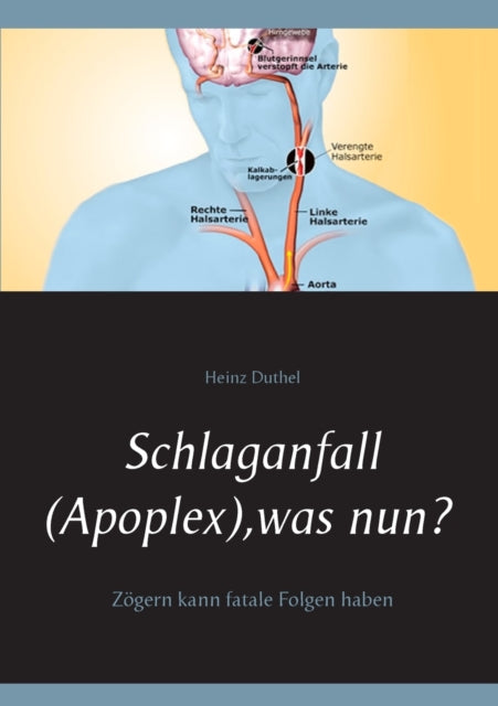 Schlaganfall (Apoplex), was nun?: Zögern kann fatale Folgen haben