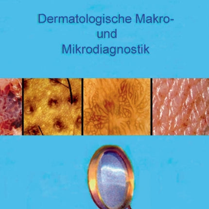 Dermatologische Makro- und Mikrodiagnostik: Erklärte Diagnosen A-Z