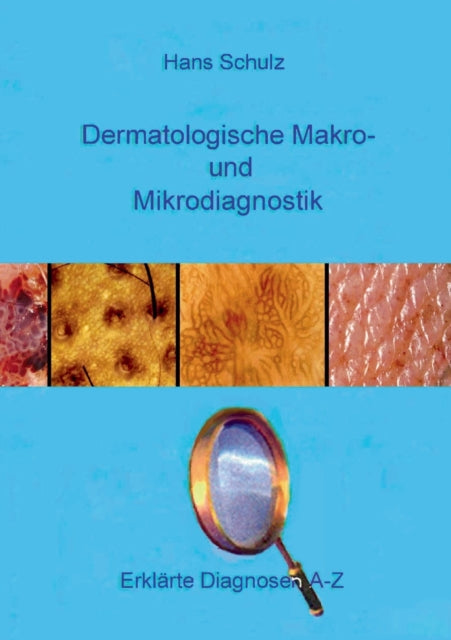 Dermatologische Makro- und Mikrodiagnostik: Erklärte Diagnosen A-Z