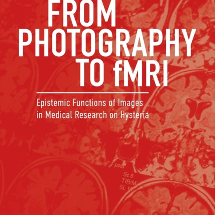 From Photography to fMRI: Epistemic Functions of Images in Medical Research on Hysteria