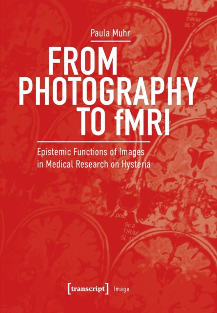 From Photography to fMRI: Epistemic Functions of Images in Medical Research on Hysteria