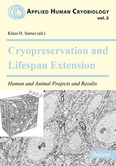 Cryopreservation and Lifespan Extension: Human and Animal Projects and Results