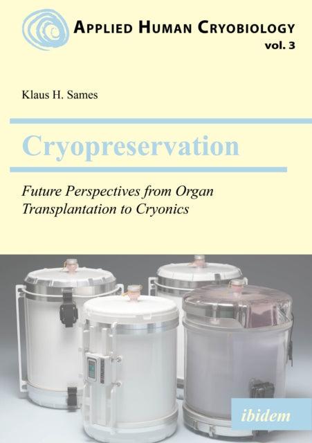 Cryopreservation