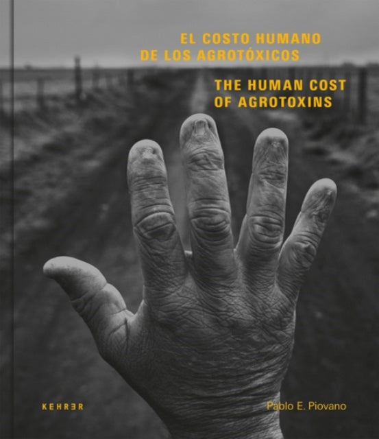 The Human Cost: Agrotoxins in Argentina