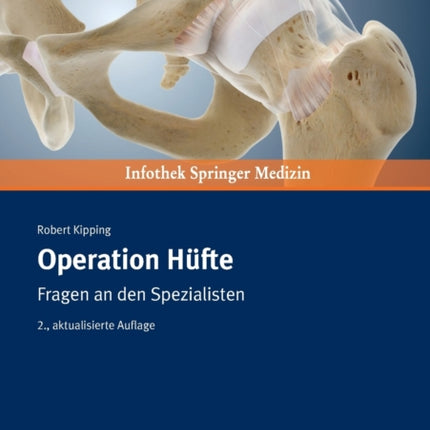Operation Hüfte: Fragen an den Spezialisten