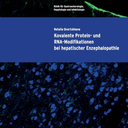 Kovalente Protein- und RNA-Modifikationen bei hepatischer Enzephalopathie