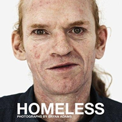 Bryan Adams: Homeless