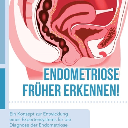 Endometriose früher erkennen! Ein Konzept zur Entwicklung eines Expertensystems für die Diagnose der Endometriose