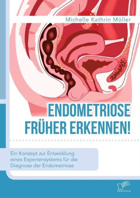 Endometriose früher erkennen! Ein Konzept zur Entwicklung eines Expertensystems für die Diagnose der Endometriose