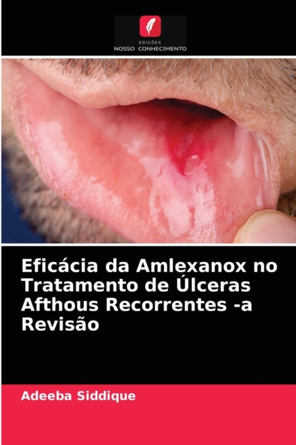 Eficácia da Amlexanox no Tratamento de Úlceras