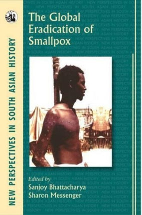 The Global Eradication of Smallpox