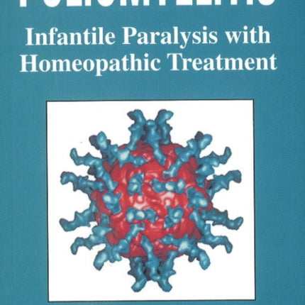 Poliomyelitis: Infantile Paralysis with Homeopathic Treatment