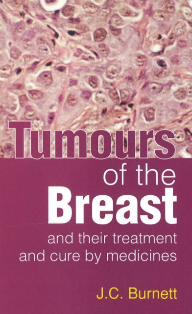 Tumours of the Breast: & Their Treatment & Cure by Medicines