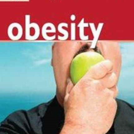 50 Things that Cause Obesity