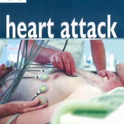 50 Things that Cause Heart Attack