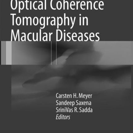 Spectral Domain Optical Coherence Tomography in