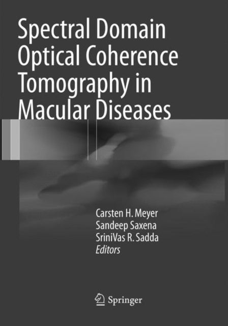 Spectral Domain Optical Coherence Tomography in