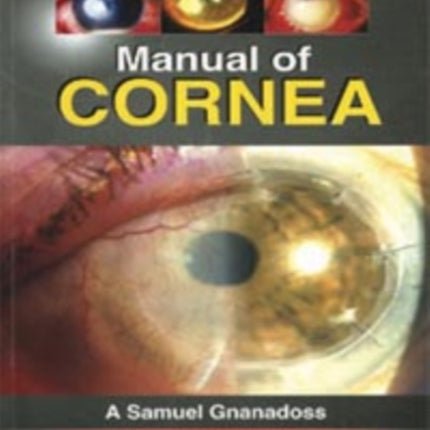 Manual of Cornea