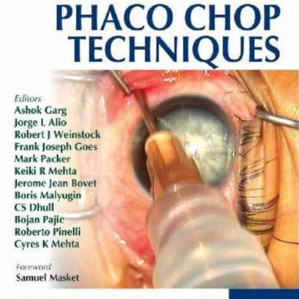 Mastering Phaco Chop Techniques