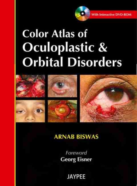 Color Atlas of Oculoplastic  Orbital Disorders