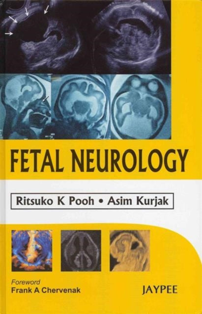 Fetal Neurology