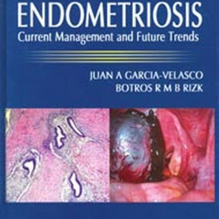 Endometriosis: Current Management and Future Trends