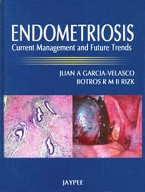 Endometriosis: Current Management and Future Trends