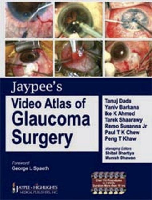 Jaypees Video Atlas of Glaucoma Surgery