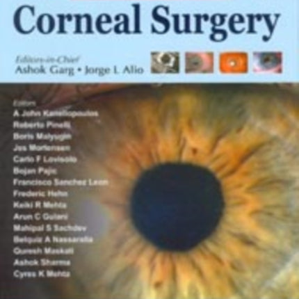 Surgical Techniques in Ophthalmology: Corneal Surgery