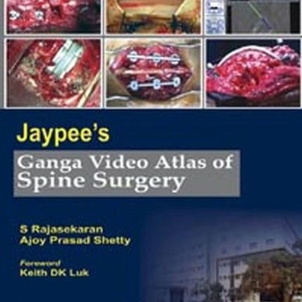 Jaypees Ganga Video Atlas of Spine Surgery